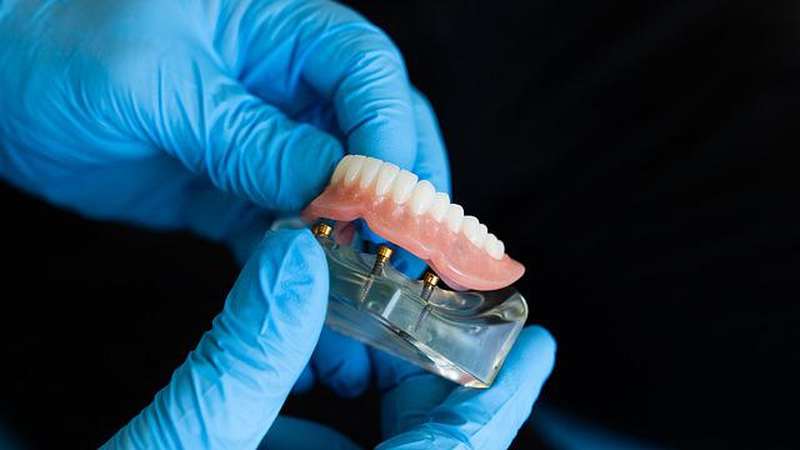  zobna protetika